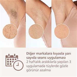 Philips Lumea 8000 Serisi BRI940/00 IPL Tüy Alma, Vücut için 1 Başlık, Çanta